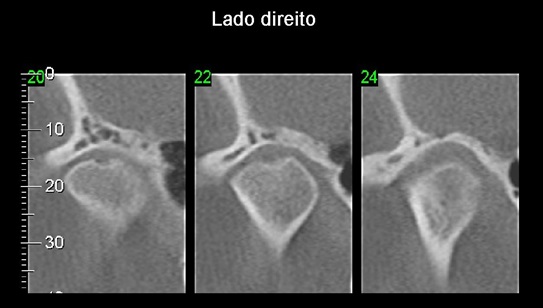 Imagem 12 pagina 16