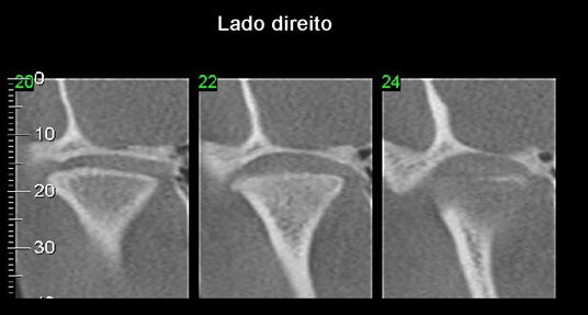 Imagem 13 pagina 17