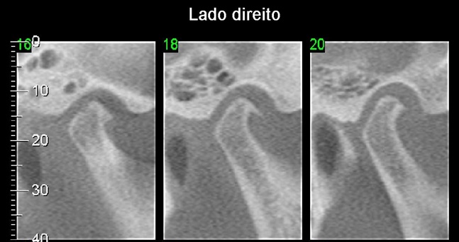 Imagem 17 pagina 21