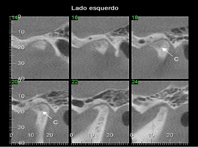 Imagem 18 pagina 22