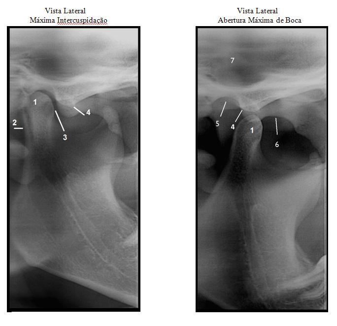 Durerile articulare: cauze, diagnostic, tratament | cooperativadaciaunita.ro