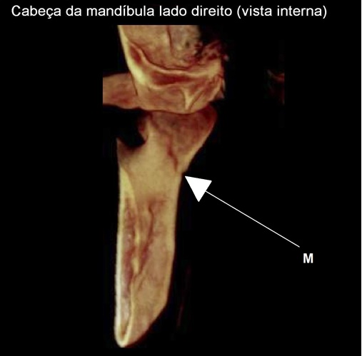 Imagem 25 pagina 30
