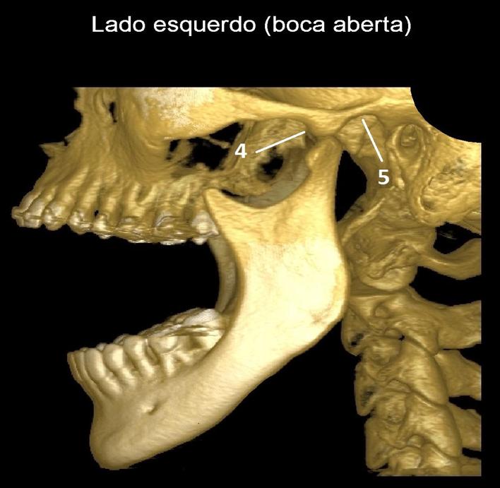 Imagem 4 pag 5