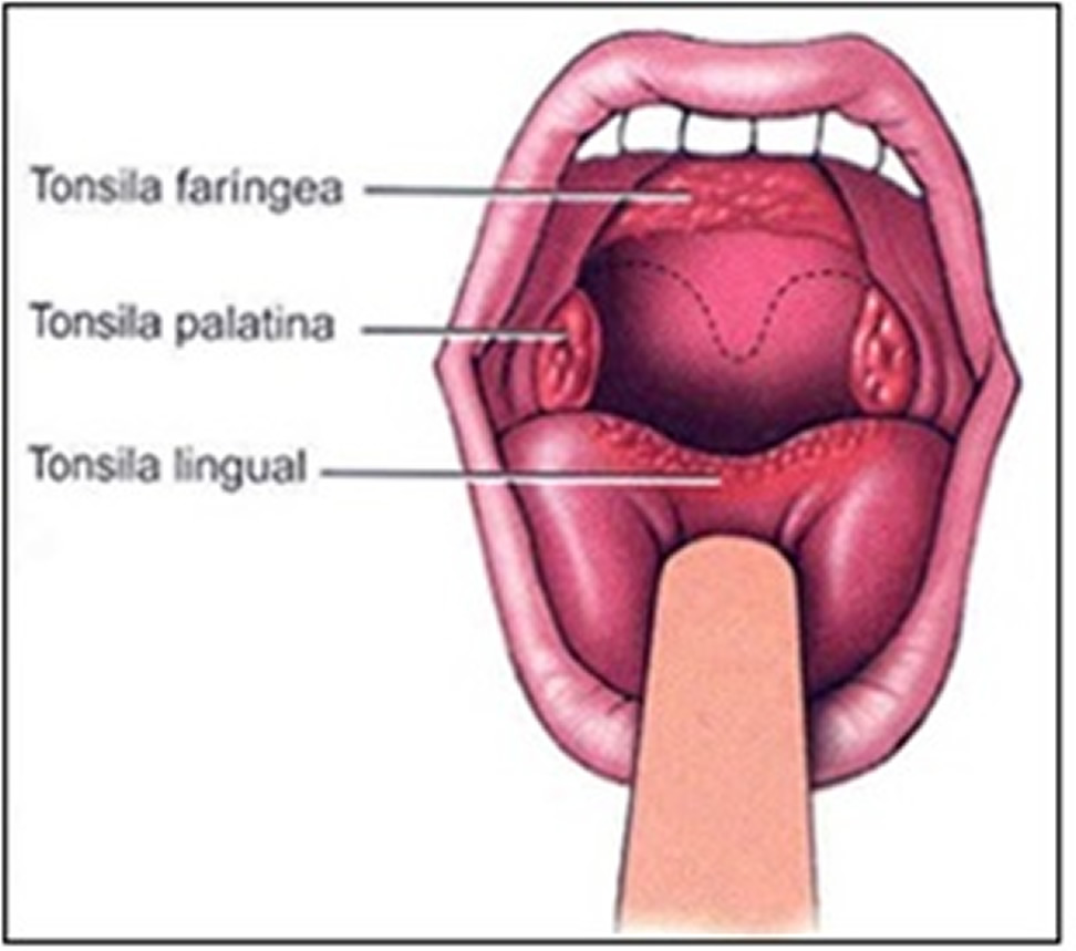Esquema da localização anatômica das tonsilas . Fonte : http://www.auladeanatomia.com/linfatico/linfa.htm